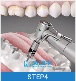 step04