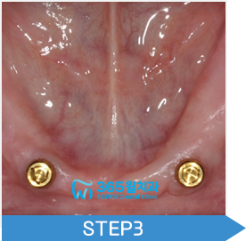 step03