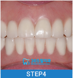 step04
