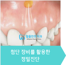 1.첨단 장비를 활용한 정밀진단